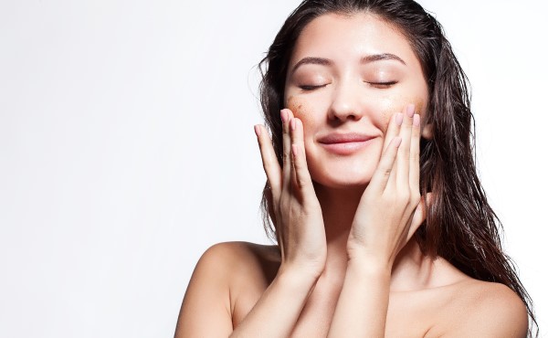Young woman with hyperpigmentation